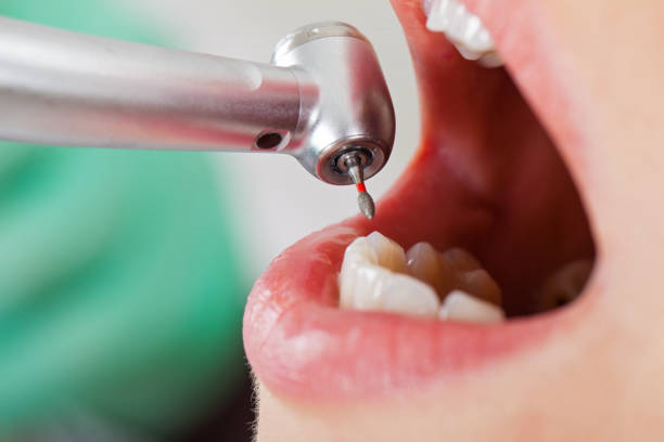  Haynesville, LA Emergency Dentist Pros